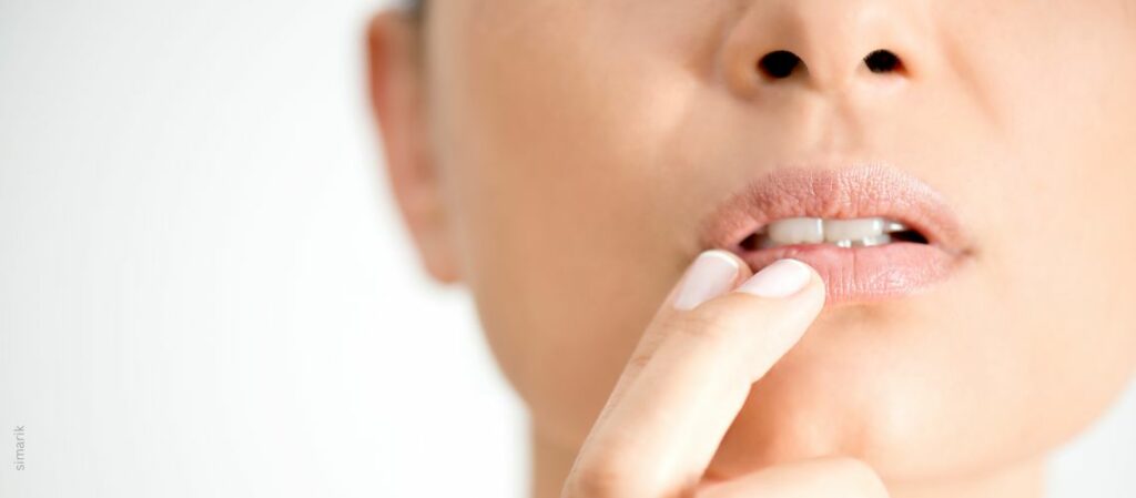 Herpes - Frau hält Finger an die Lippen - Hilft Holunder gegen Herpesviren?